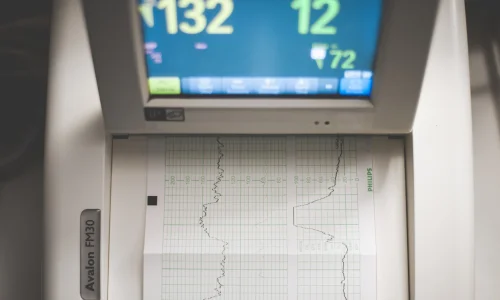 Importance of Regular Health Checkups for a Healthy Life 33