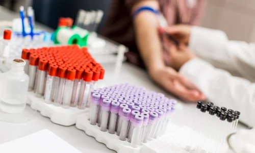 Importance of Regular Health Checkups for a Healthy Life 39